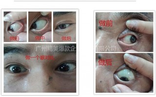 散光眼镜是要多少钱，散光眼镜价格大概多少