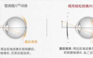 视力里的轴位是什么意思，视力的轴位是什么意思